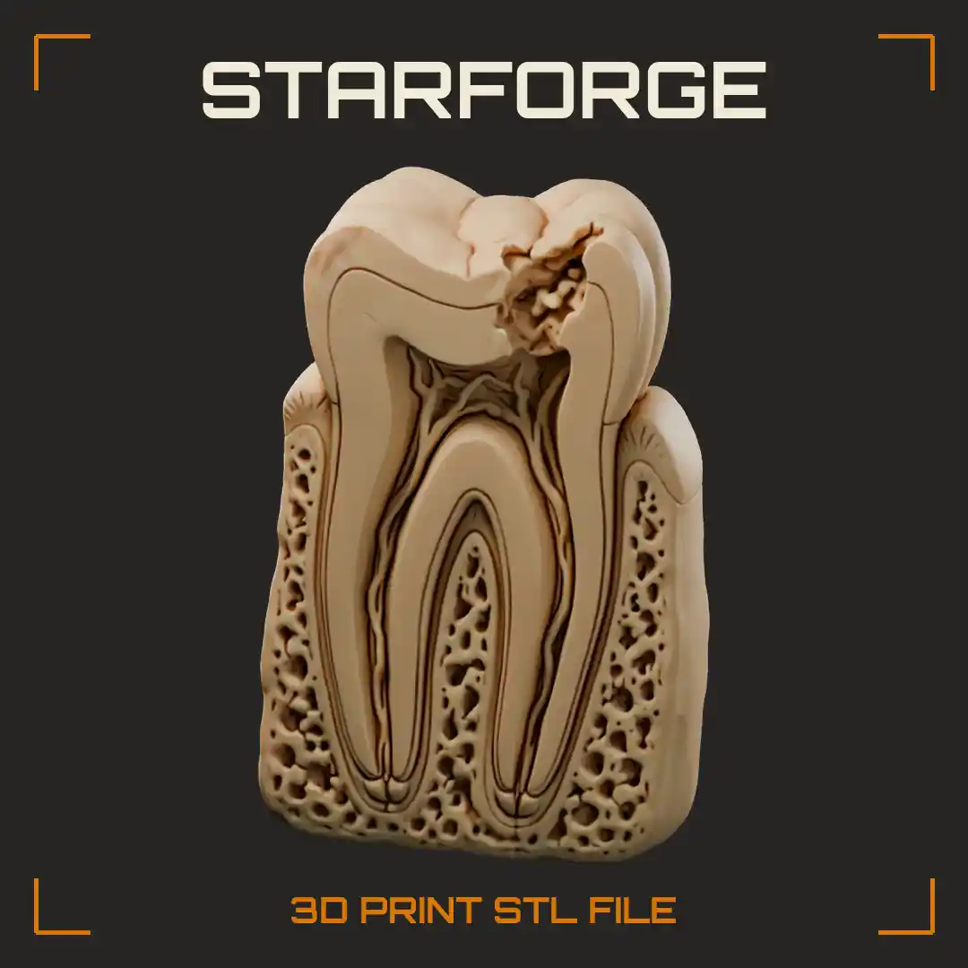 Molar Decay Cavity Cross Section with Enamel Breach Dentin Lesion Pulp Chamber and Roots - 3D Printable STL File